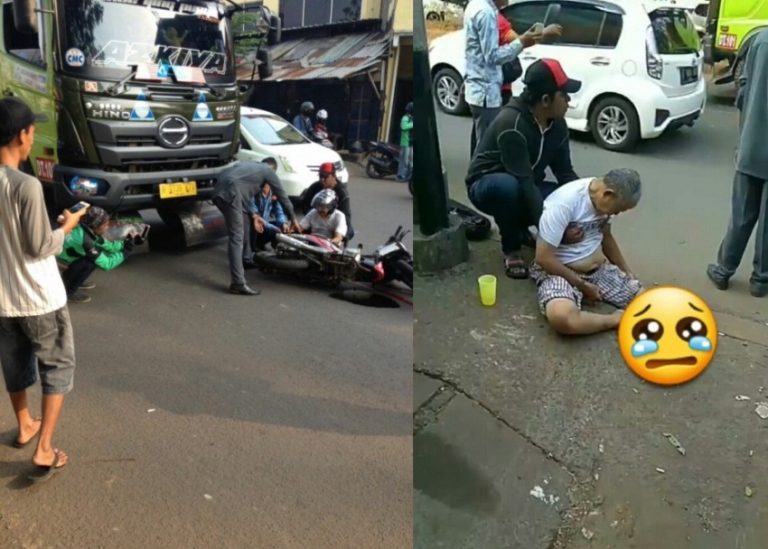 Alami kecelakaan pria tua ini tertunduk tak bisa berkata kata melihat kakinya yang hancur terlindas truk 3