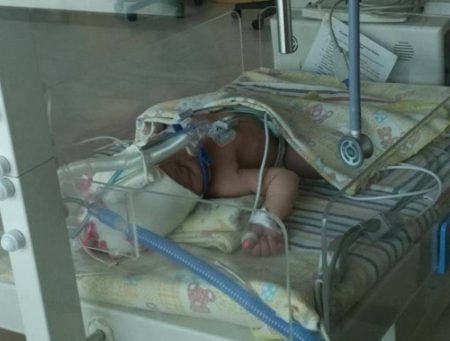 Baru lahir empat hari yang lalu dengan proses caesar bayi ini alami kelainan jantung dan butuh donasi ASI