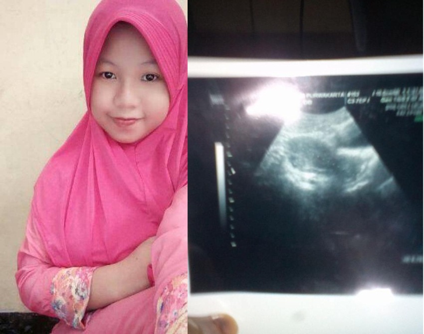 Ceritakan bahaya KB suntik, 3 bulan gak haid wanita ini kaget saat dokter bilang rahimnya begini