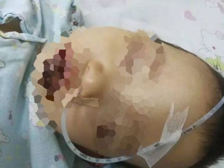 Dikira susu bubuk gadis kecil ini kunyah deterjen dan akibatnya bikin ngeri 3