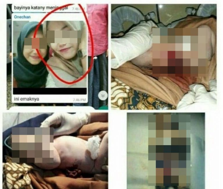 Tertega Melahirkan seorang diri di kamar mandi bayi ini alami luka sobek di perut dan cakaran di bagian dada min 2