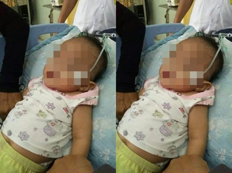 Cerita pilu bayi tuna netra asal Aceh yang bikin berurai air mata Dokter Mamaku Dimana
