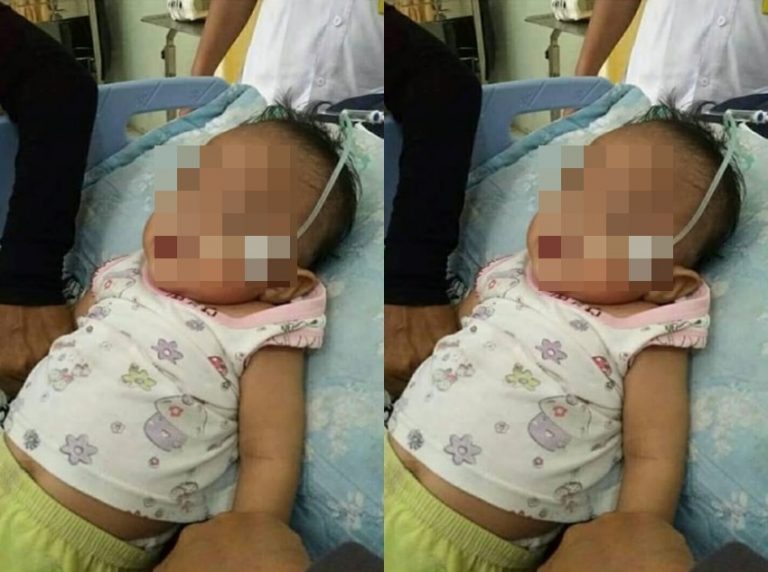 Cerita pilu bayi tuna netra asal Aceh yang bikin berurai air mata Dokter Mamaku Dimana