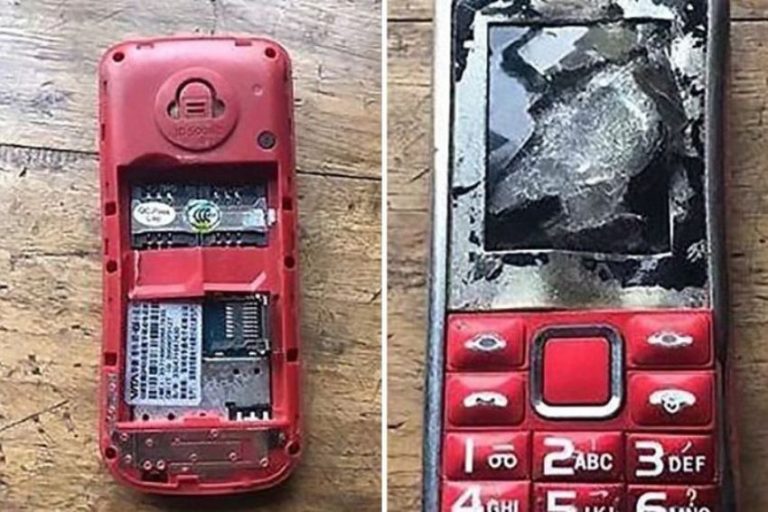 Handphone miliknya meledak saat sedang dicas jari tangan bocah ini putus dan mata kanannya buta