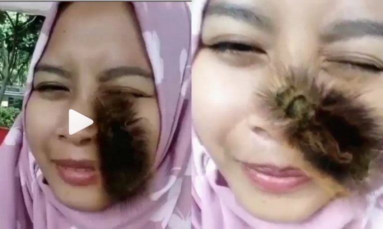 Wajahnya dijamah ulat bulu ekspresi gadis ini nggak nahan bae bae itu muka jadi bengkak neng