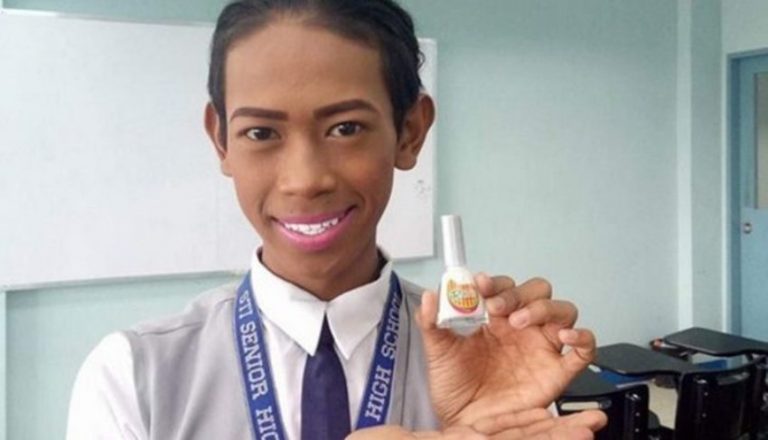 Senyum lebar pemuda ini pamerkan gigi putih bikin iri rahasia kinclongnya malah bikin ngakak aya aya wae