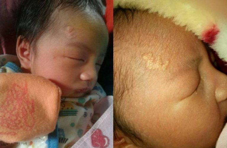 Punya lafadz Allah di dahi bayi ini lahir dari keluarga kurang mampu di Kalimantan