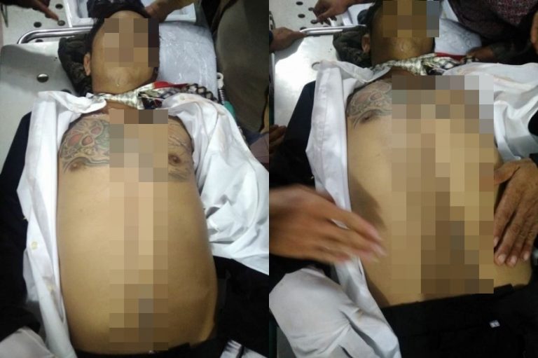 Usai di autopsi tubuh jenazah ini penuh luka jahitan keluarga histeris dan menduga korban alami pencurian organ