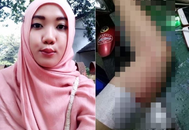 Cabut KB implan di lengan ibu muda ini alami pendarahan kok ngeri ya