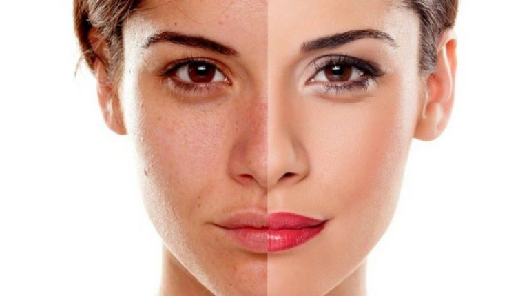 8 cara alami untuk mencerahkan wajah yang kusam