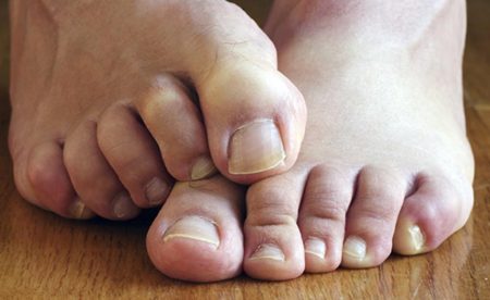 5 cara menghilangkan bau kaki