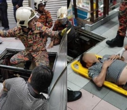 Gara-gara hal spele ini, Seorang pria terjepit eskalator hingga nyaris kehilangan kakinya