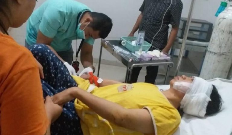 Viral perempuan digigit anjing pitbull di Makassar begini kronologinya