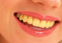 6 Kebiasaan yang menjadi penyebab gigi menjadi kuning
