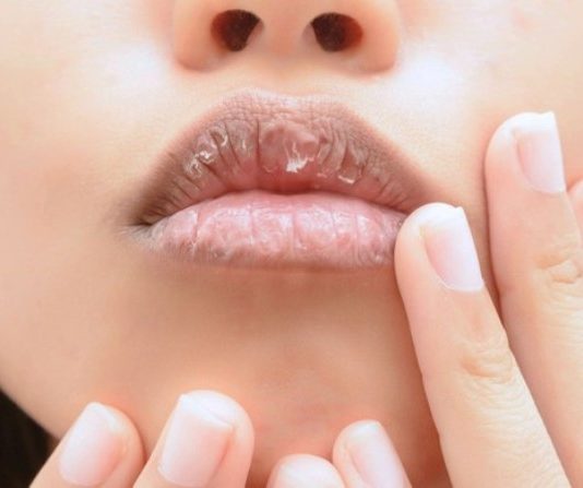 Penyebab bibir hitam yang tak Anda sadari